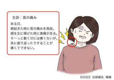 【症例集】首の痛み(2)