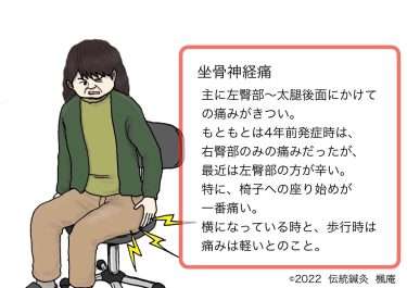 【症例集】坐骨神経痛(2)