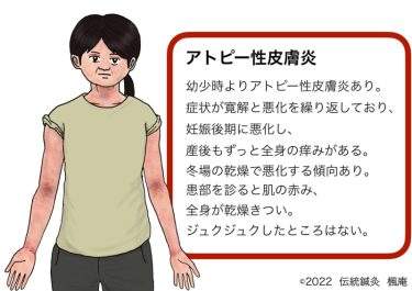 【治療日誌】アトピー性皮膚炎 no.1