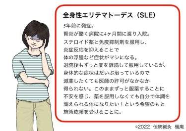 【症例集】全身性エリテマトーデス（SLE）