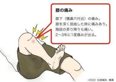 【治療日誌】膝の痛み  No.1