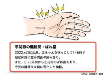 【治療日誌】手関節の腱鞘炎・ばね指  No.1
