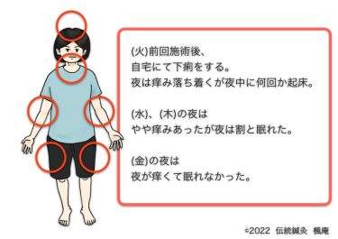 【治療日誌】アトピー性皮膚炎(2) No.2
