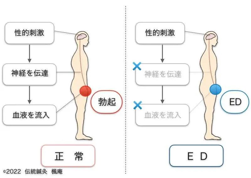 勃起 浜松町第一クリニック