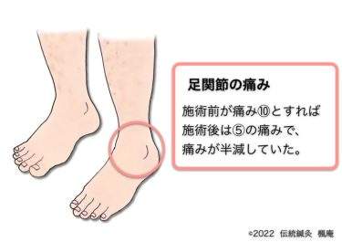 【治療日誌】足関節の痛み・アトピー性皮膚炎(4) No.2