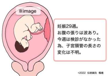 【治療日誌】低置胎盤 No.3