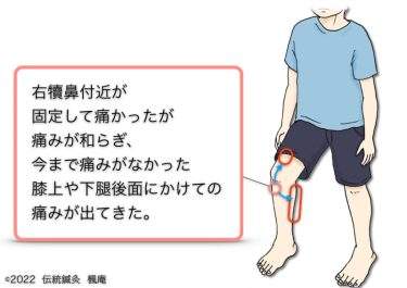 【治療日誌】変形性膝関節症 No.8