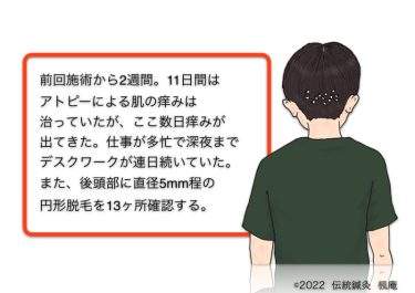 【治療日誌】アトピー性皮膚炎(4) No.4