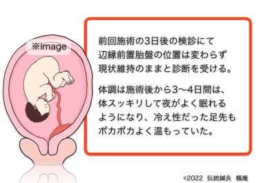 【治療日誌】辺縁前置胎盤(4) No.2