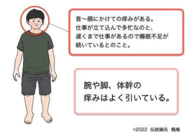 【治療日誌】足関節の痛み・アトピー性皮膚炎(4) No.3
