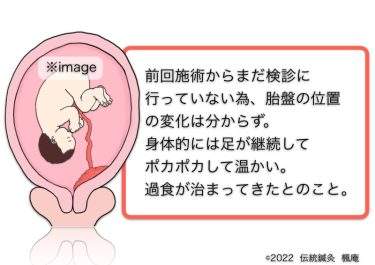 【治療日誌】辺縁前置胎盤(4) No.3