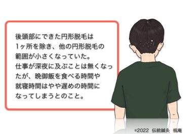 【治療日誌】アトピー性皮膚炎(4) No.5