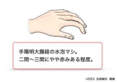 【治療日誌】手湿疹 No.12