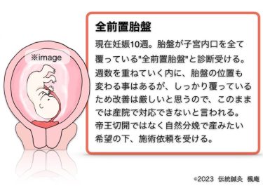 【治療日誌】全前置胎盤(5) No.1