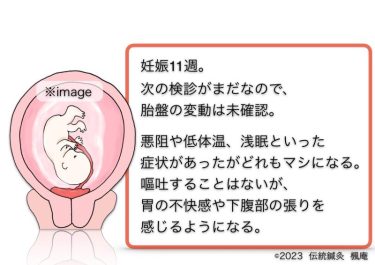 【治療日誌】全前置胎盤(5) No.2