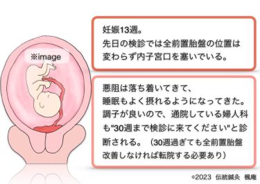 【治療日誌】全前置胎盤(5) No.3