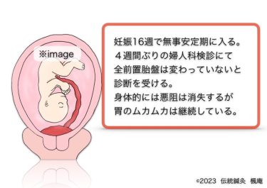 【治療日誌】全前置胎盤(5) No.4