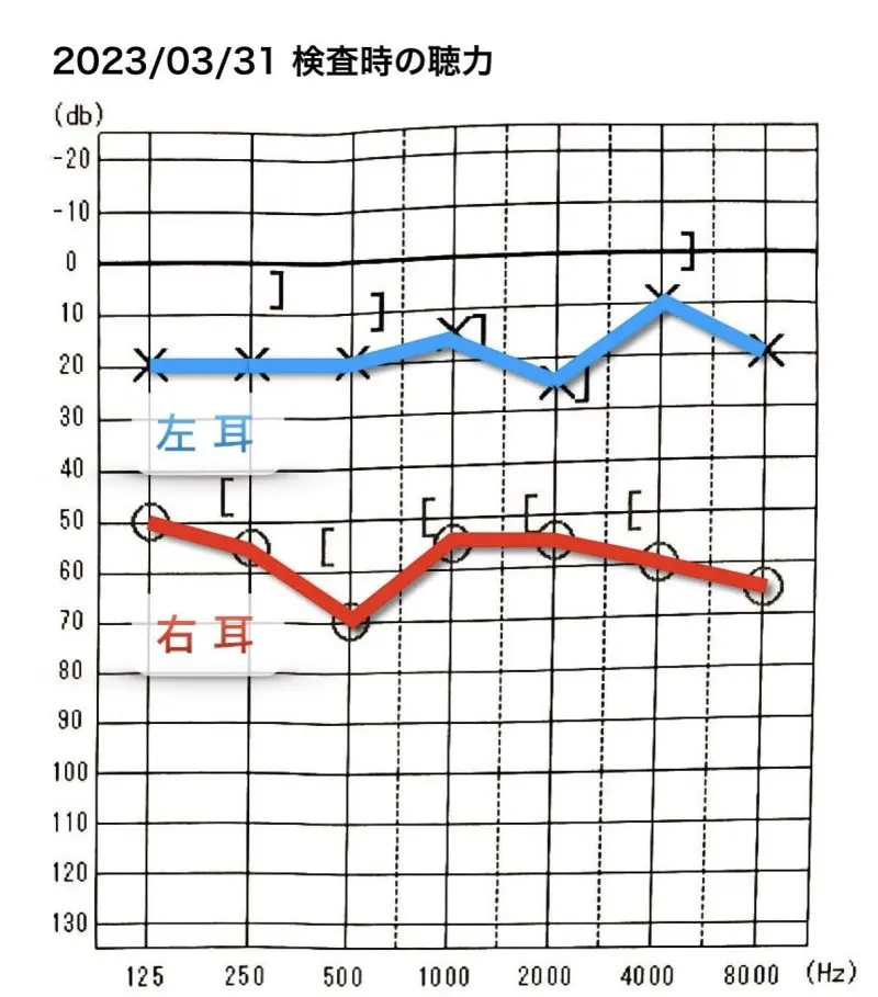 感染症・神経血管圧迫症候群を究める : 耳よりな情報教えます!裁断済み 感染症・神経血管圧迫症候群を究める: 耳よりな情報教えます