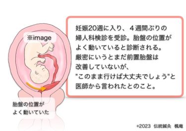 【治療日誌】全前置胎盤(5) No.5