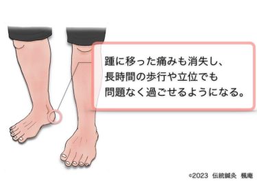 【治療日誌】アキレス腱の痛み(2) No.3