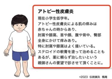 【治療日誌】アトピー性皮膚炎(12) No.1