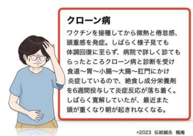 【症例集】クローン病(2)