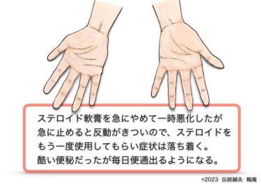 【治療日誌】手湿疹(3) No.2