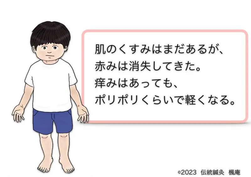 [断裁済]Derma. エキスパートへの近道！間違えやすい皮膚疾患の見極め Amazon.co.jp: 好発部位でみる皮膚疾患アトラス 躯幹・四肢