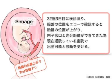 【治療日誌】低置胎盤(2) No.2