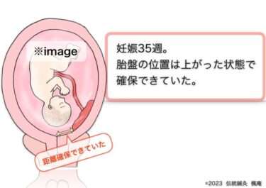 【治療日誌】低置胎盤(2) No.3