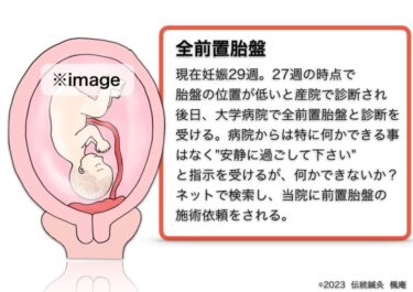 【治療日誌】全前置胎盤(7) No.1