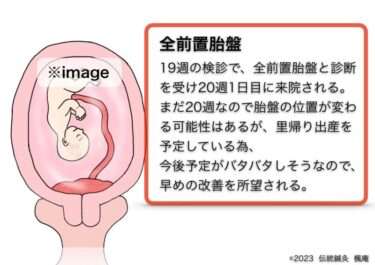 【治療日誌】全前置胎盤(8) No.1