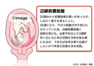 【治療日誌】辺縁前置胎盤(9) No.1