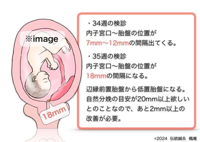 九伝流 理(ことわり)  ＋いのり(腹部調整法)  網戸理九 Amazon.co.jp: 網戸理九: 本、バイオグラフィー、最新アップデート