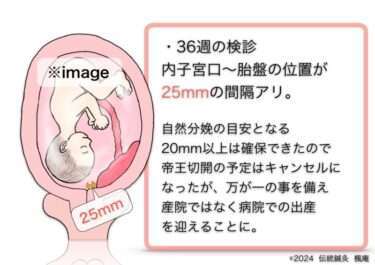 【治療日誌】辺縁前置胎盤(9) No.3