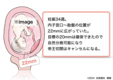 【治療日誌】低置胎盤(11) No.2