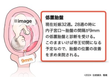 【治療日誌】低置胎盤(11) No.1