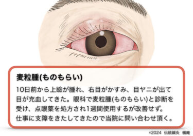 【治療日誌】麦粒腫(ものもらい)(1)