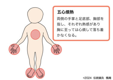 【用語集】五心煩熱