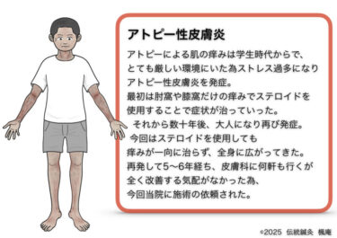 アトピー性皮膚炎