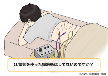 【Q&A】電気を用いた鍼施術について