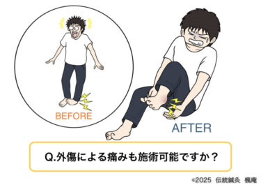 【Q&A】外傷でも鍼治療は可能ですか？