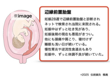 【治療日誌】辺縁前置胎盤(13)