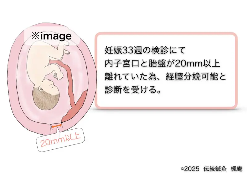ライブディオΖX 前期