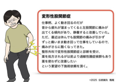 変形性股関節症