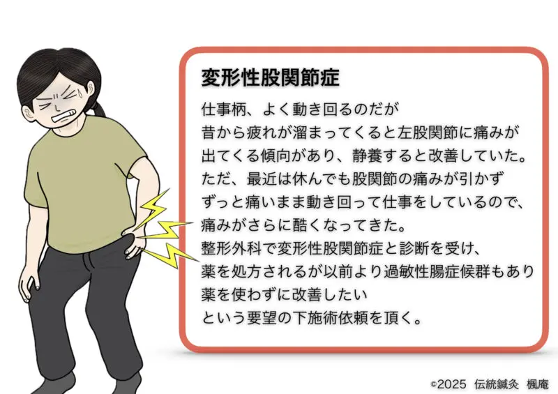 変形性股関節症