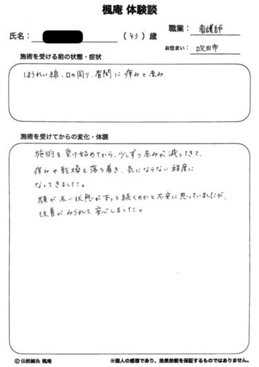【体験談】酒さ・接触性皮膚炎：大阪府吹田市のN.Wさん
