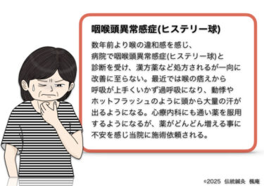 咽喉頭異常感症(ヒステリー球)