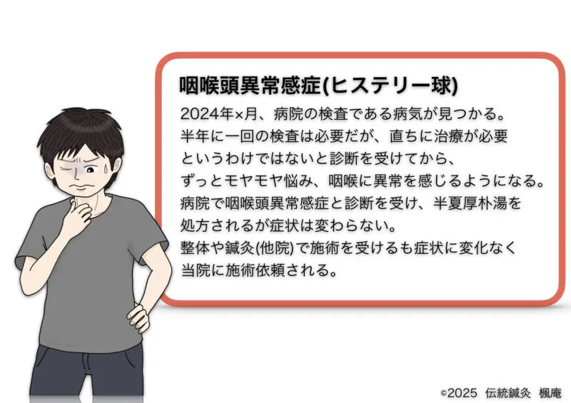 咽喉頭異常感症(ヒステリー球)