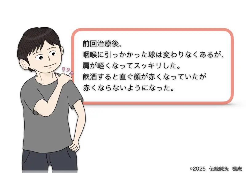 咽喉頭異常感症(ヒステリー球)